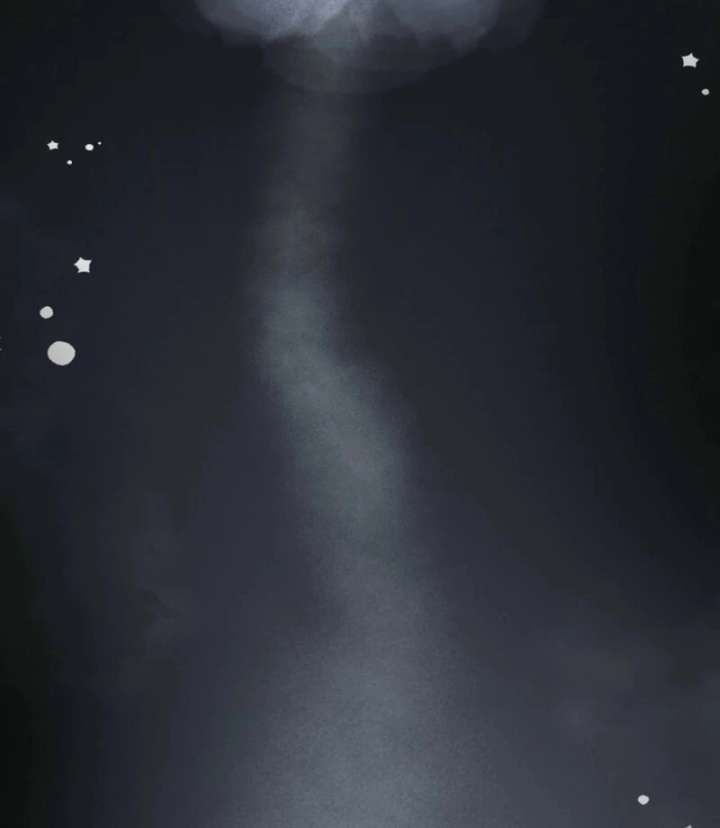 113