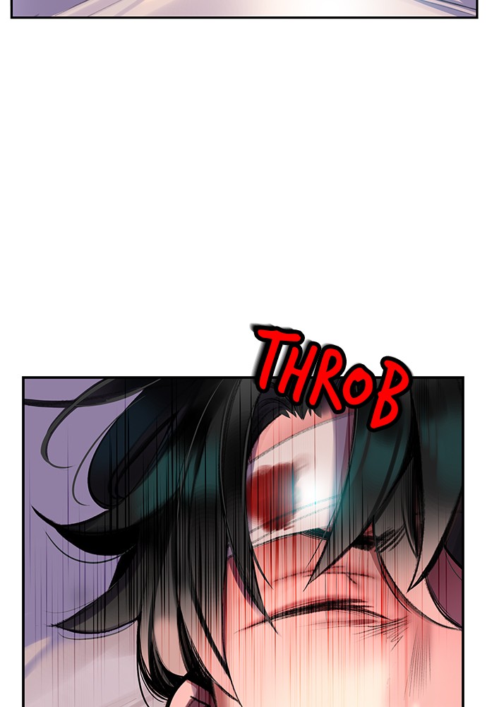 87