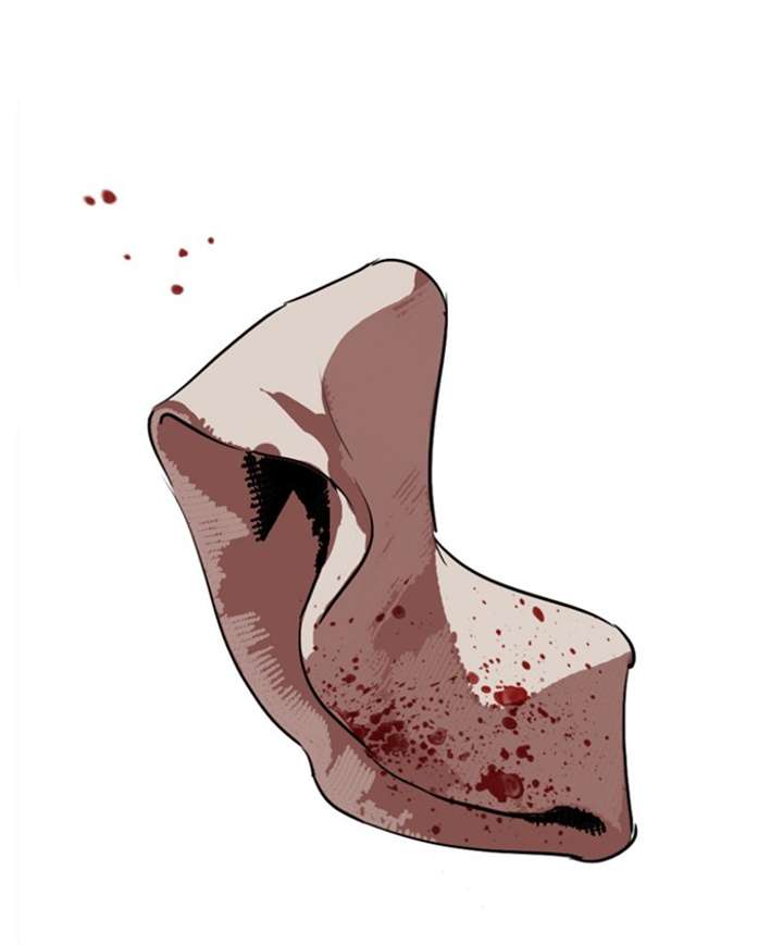 ch 279 209